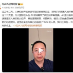 周鸿祎：人类命运已被改变 AI某些方面已超越99%人类